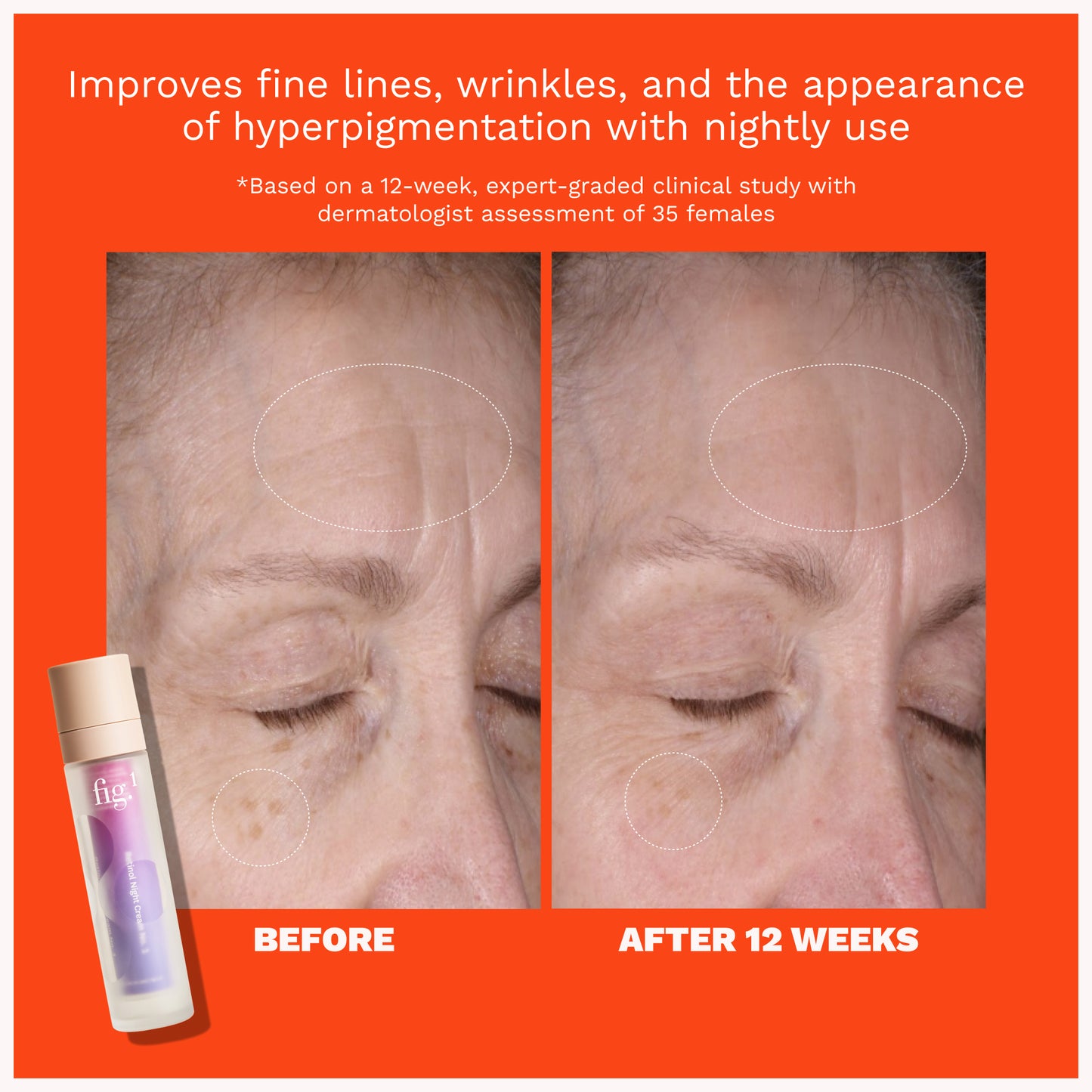 Retinol Night Cream Level 1