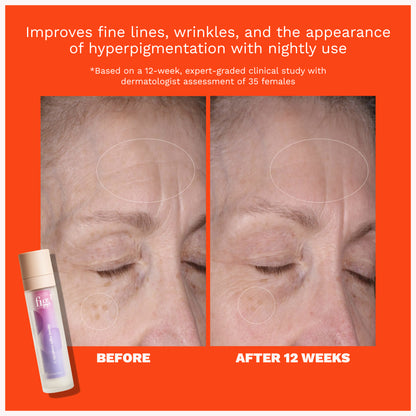 Retinol Night Cream Level 1